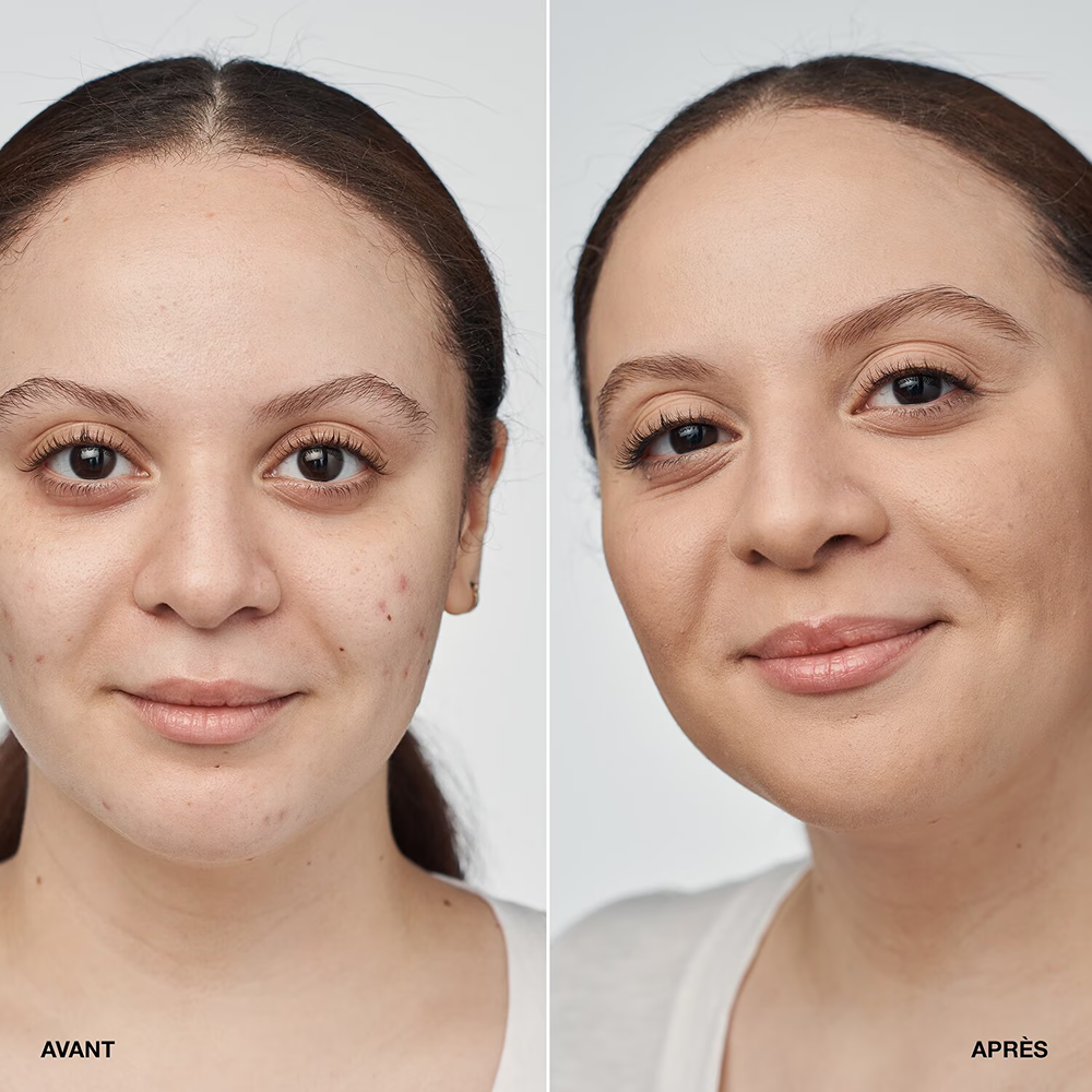Clinique Even Better Clinical Serum Foundation Spf20 - Fondotinta Siero