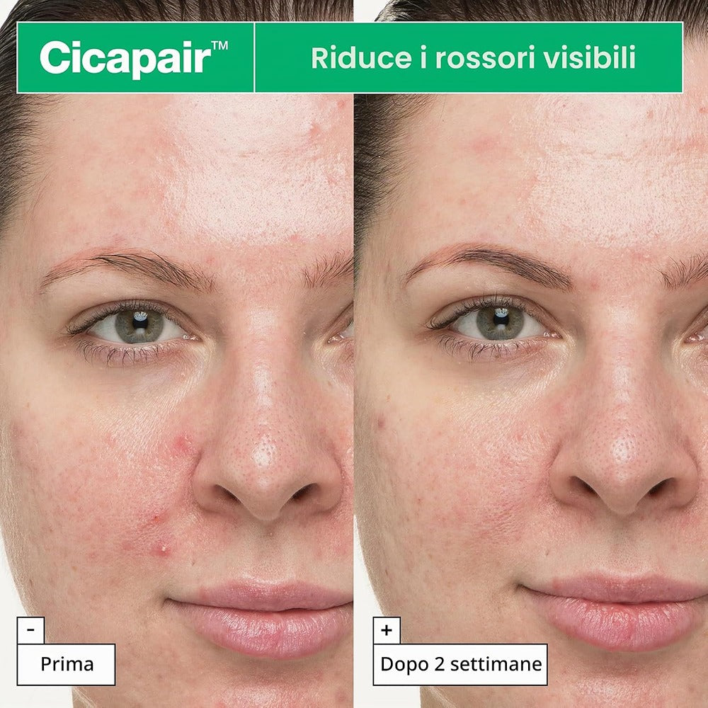 Dr.Jart+ Cicapair So Soothing Treatment - Trattamento Lenitivo